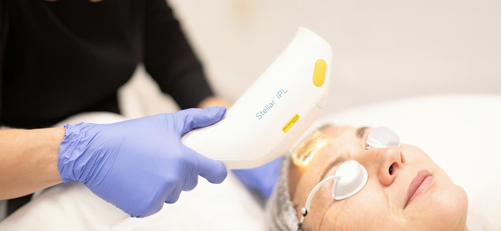 Combining IPL and ResurFX: A Guide to Skin Tone and Texture