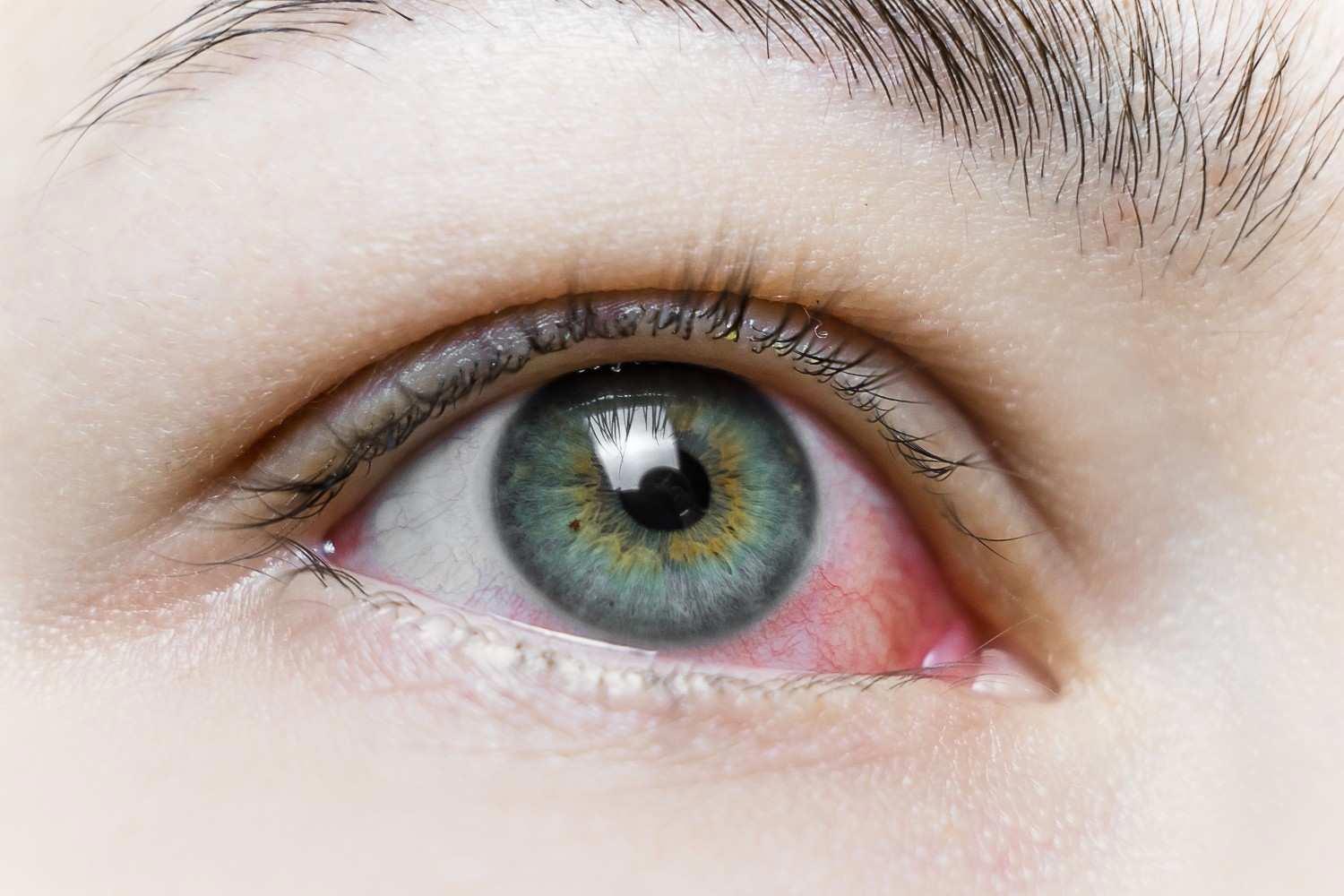 Close-up of a human eye with visible detail in the iris, lashes and surrounding skin.