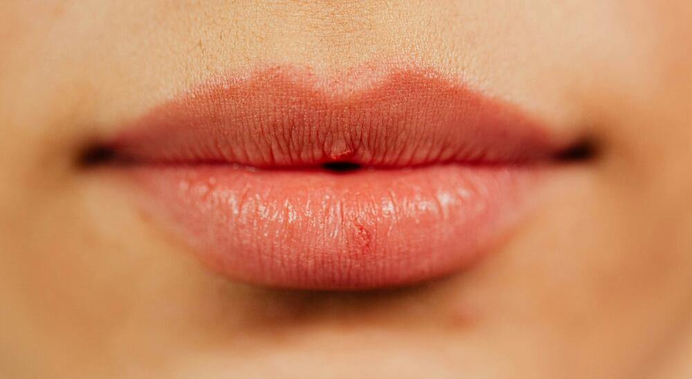 Close-up of natural-looking lip filler results with preserved texture.