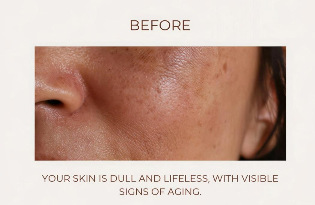 Close-up before image of facial skin showing dull tone, uneven texture and visible early signs of ageing before a HydraFacial treatment.