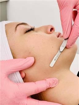 Esthetician performing a dermaplaning exfoliation treatment on a client's face at SVIT Aesthetics in Southlake